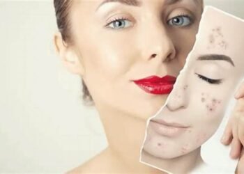 Crème de nuit anti-imperfections : la solution pour une peau nette et éclatante