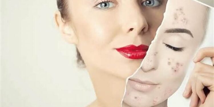 Crème de nuit anti-imperfections : la solution pour une peau nette et éclatante