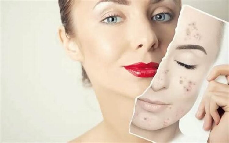 Crème de nuit anti-imperfections : la solution pour une peau nette et éclatante