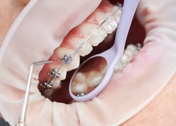 Découvrez le meilleur dentiste à Marrakech pour votre santé dentaire