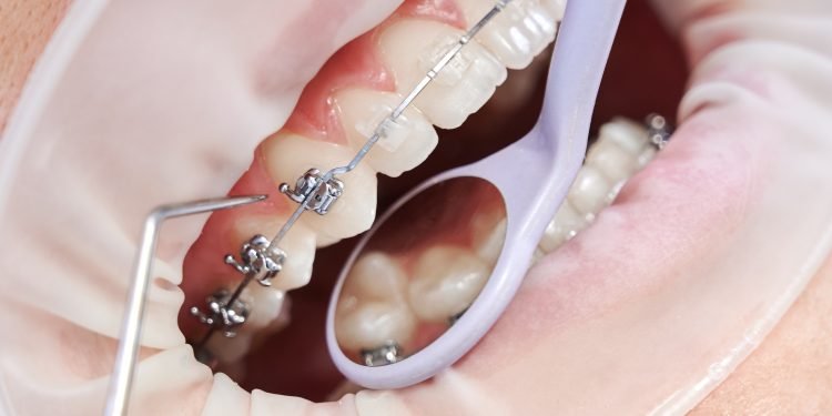 Découvrez le meilleur dentiste à Marrakech pour votre santé dentaire